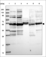 FGFR1OP Antibody in Western Blot (WB)