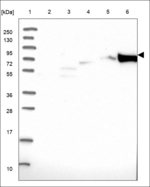 FAM160A2 Antibody in Western Blot (WB)