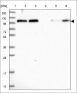 FAM160B1 Polyclonal Antibody
