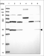 C20orf196 Polyclonal Antibody