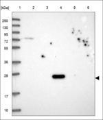 REC114 Polyclonal Antibody
