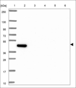 KIAA1609 Polyclonal Antibody