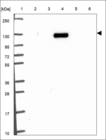 BTBD11 Polyclonal Antibody