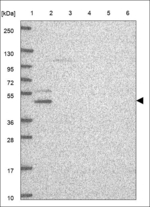 ZNF587B Antibody in Western Blot (WB)