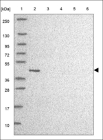 CBWD2 Polyclonal Antibody