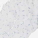 ATF6 Antibody in Immunohistochemistry (Paraffin) (IHC (P))