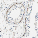 ATF6 Polyclonal Antibody