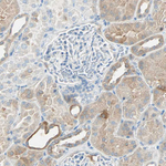 ATF6 Antibody in Immunohistochemistry (Paraffin) (IHC (P))