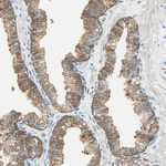 ATF6 Antibody in Immunohistochemistry (Paraffin) (IHC (P))