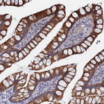 IL-7 Antibody in Immunohistochemistry (Paraffin) (IHC (P))