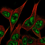 Parkin Polyclonal Antibody