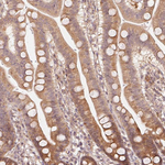 Parkin Antibody in Immunohistochemistry (Paraffin) (IHC (P))
