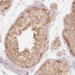 Parkin Antibody in Immunohistochemistry (Paraffin) (IHC (P))