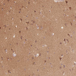 Parkin Antibody in Immunohistochemistry (Paraffin) (IHC (P))