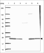 DHRS4L2 Antibody in Western Blot (WB)