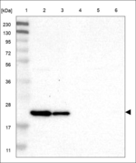 Claudin 8 Antibody in Western Blot (WB)