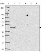 CYP4A11 Polyclonal Antibody