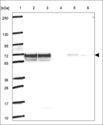 LPCAT3 Polyclonal Antibody