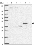 LPCAT3 Polyclonal Antibody