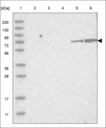 NUGGC Polyclonal Antibody