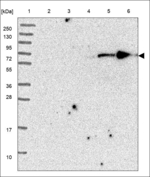 KLHL23 Polyclonal Antibody