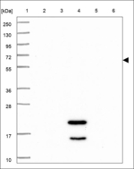 IRX4 Antibody in Western Blot (WB)