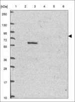 RHBDF1 Antibody in Western Blot (WB)