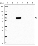 C8A Antibody in Western Blot (WB)