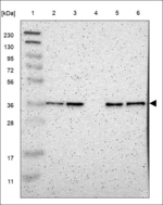 LDLRAD3 Antibody in Western Blot (WB)