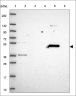 NPRL3 Antibody in Western Blot (WB)