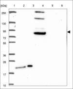 CCDC135 Antibody in Western Blot (WB)