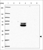 PACAP-38 Antibody in Western Blot (WB)
