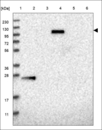 KIAA1688 Antibody in Western Blot (WB)