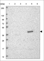 AKR7A3 Polyclonal Antibody