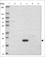 NKX6-2 Polyclonal Antibody
