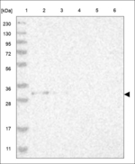 PSMC3IP Polyclonal Antibody