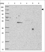 SENP6 Polyclonal Antibody