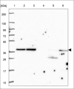 AP3M2 Polyclonal Antibody