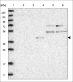 NeuroD6 Antibody in Western Blot (WB)