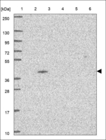 Xxylt1 Antibody in Western Blot (WB)