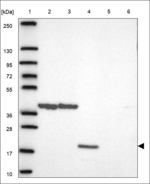 PLAC1 Polyclonal Antibody