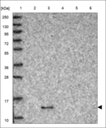 RFESD Polyclonal Antibody