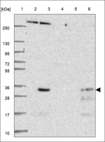 RBM38 Antibody in Western Blot (WB)