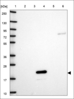 RBM38 Antibody in Western Blot (WB)