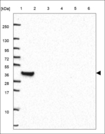 HCAR3 Polyclonal Antibody