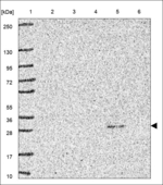 Claudin 14 Antibody in Western Blot (WB)