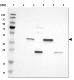 PIPOX Polyclonal Antibody