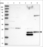 ATP5SL Antibody in Western Blot (WB)