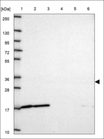 TEF Antibody in Western Blot (WB)