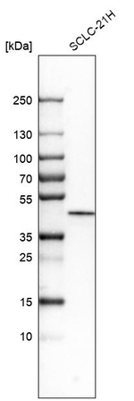 CK1 epsilon Polyclonal Antibody